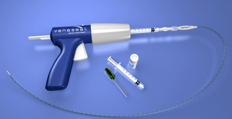 Venaseal-Applikator der Fa. Medtronic